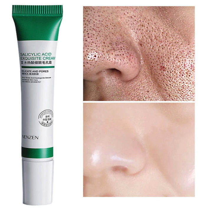 Creme Redutor de Poros com Ácido Salicílico Controle de Oleosidade Hidratação Melhora Pele Acneica